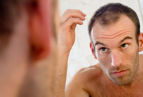 Rụng tóc ở nam giới và các thông tin cần biết 1