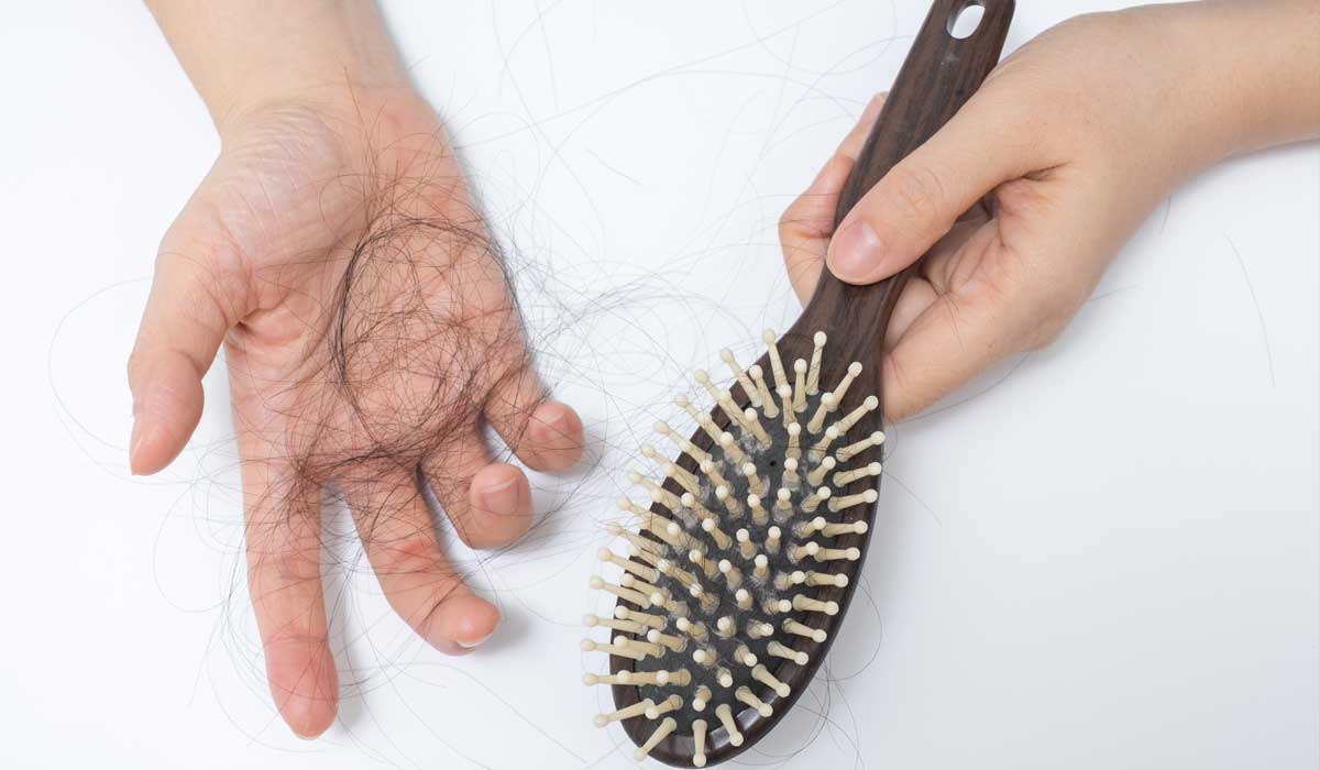 Bóc mẽ" 5 nguyên nhân rụng tóc nhiều bạn không ngờ đến