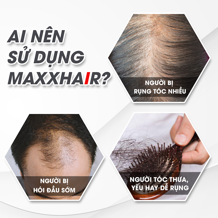 Đối tượng nào nên sử dụng Maxxhair để tóc mọc trở lại? 1