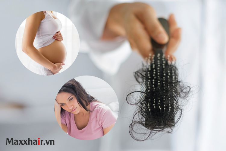 3 giai đoạn rụng tóc do nội tiết phổ biến ở phụ nữ 1