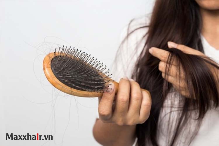 Dấu hiệu nhận biết một mái tóc bị ảnh hưởng sau sốt xuất huyết 1