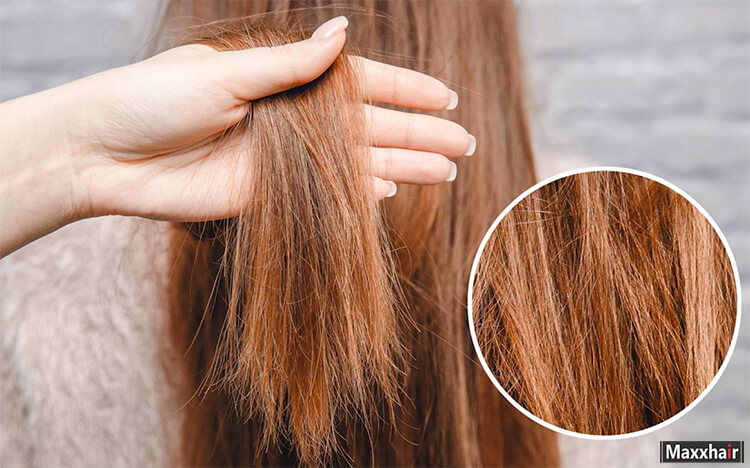 Nối tóc có thể gây nhiều tác hại với tóc và da đầu