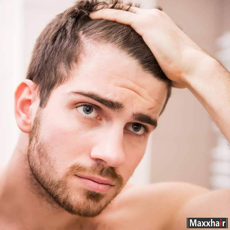 Vuốt tóc nhiều có thể khiến tóc hư tổn, khô và chẻ ngọn