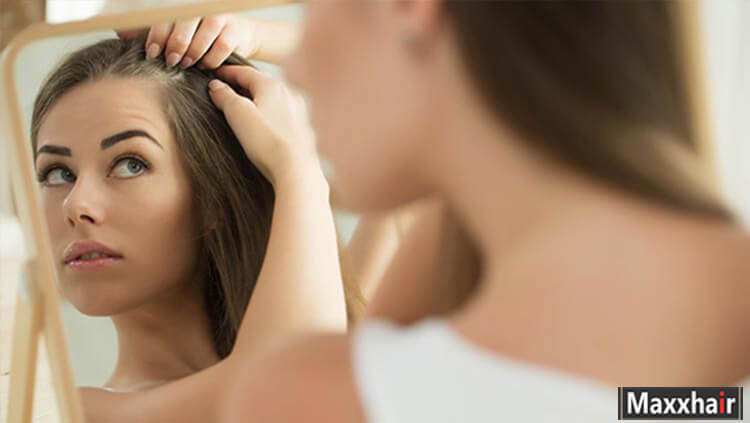 Rất nhiều người bị mắc “bệnh nghiện nhổ tóc” khiến tóc khó mọc lại được