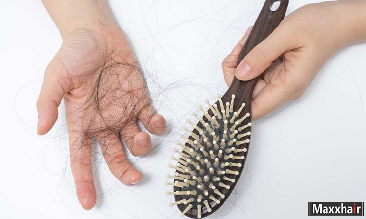 Yếu tố di truyền có thể là nguyên nhân gây rụng tóc nhiều